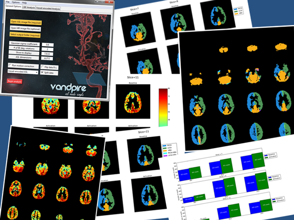 VANDPIRE ASL Toolbox